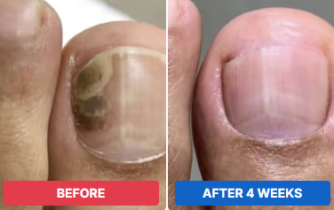 Cristine, AZ before and after 4 weeks