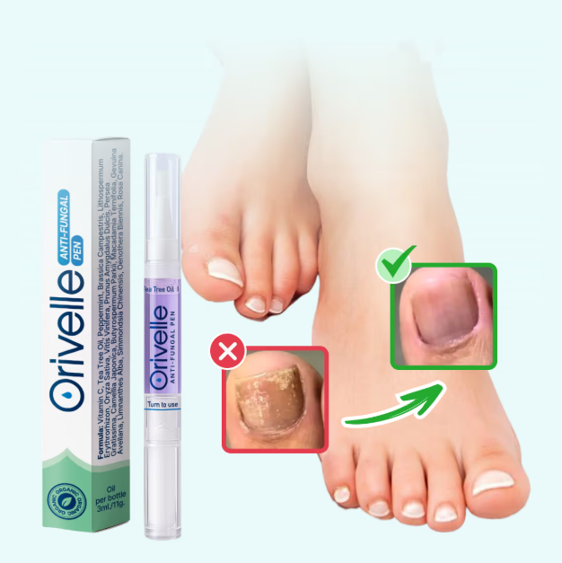 Orivelle Anti-Fungal Pen with before and after toenail results